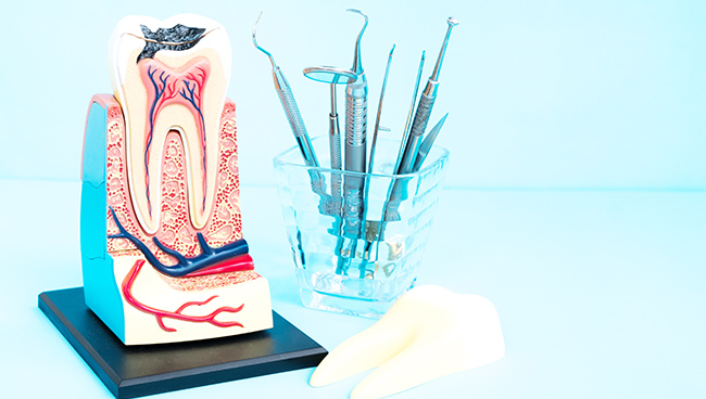 虫歯治療